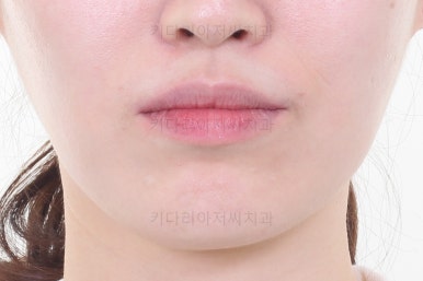 부산교정치과