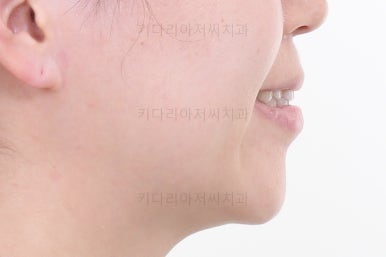 부산연산동치과