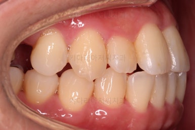 부산연산동치과