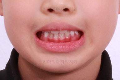 부산어린이교정