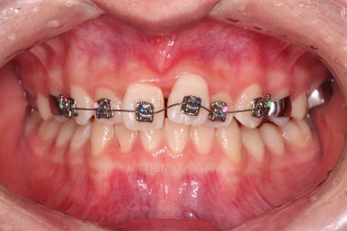 부산청소년교정치과