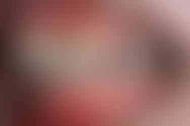 부산연산동교정치과