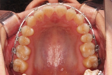 부산치아교정치과