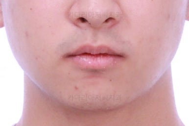 부산교정치과추천