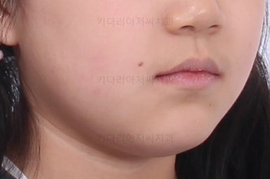 부산초등학생교정