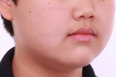 부산교정치과추천
