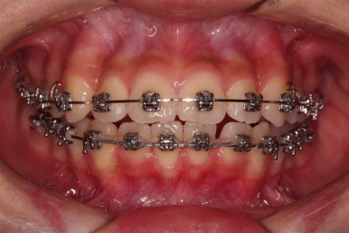 부산치아교정치과