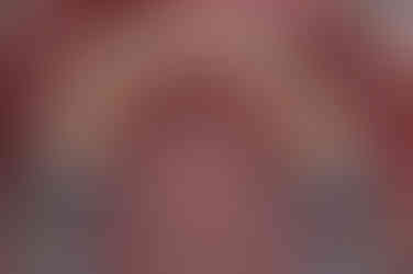 부산매복치아교정