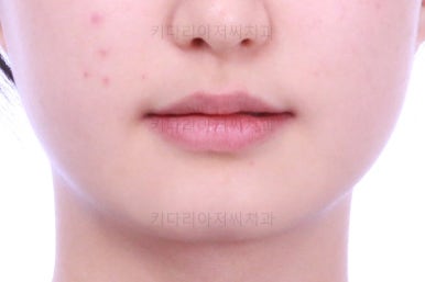 동래구치아교정