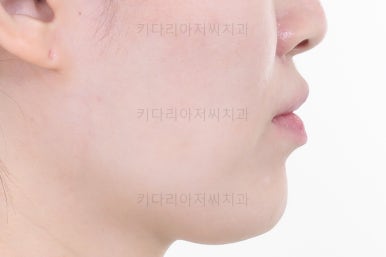 부산교정치과