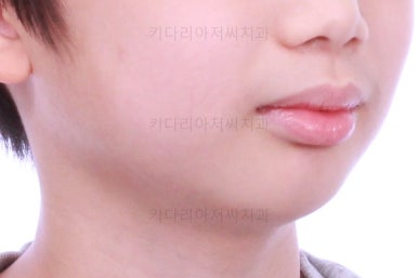 부산어린이교정