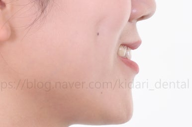 부산인비절라인