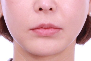 연산동부분교정