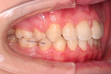 부산교정치과추천