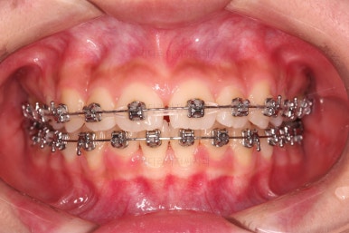 부산치아교정치과