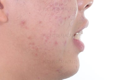 부산교정치과