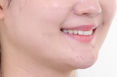 부산인비절라인