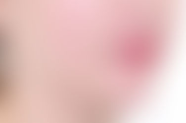 부산개방교합