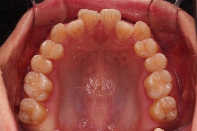 부산치아교정치과