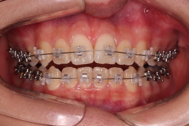 부산교정전문의