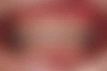 부산교정전문의