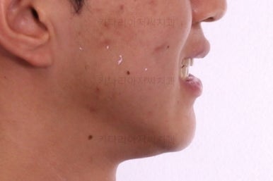 연산동교정전문치과