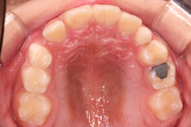 부산어린이교정