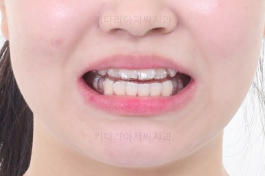 부산교정전문의