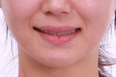 연산동교정치과