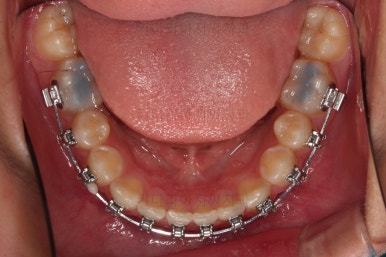 부산청소년교정치과