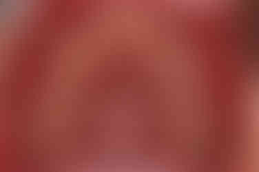 부산교정잘하는치과