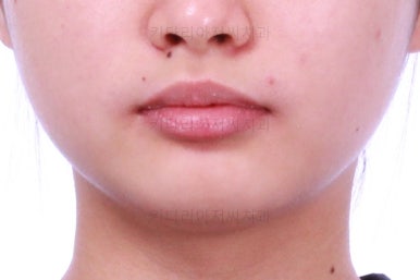 부산치아교정치과