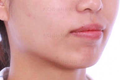 부산연산역치아교정