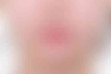 연산동교정치과