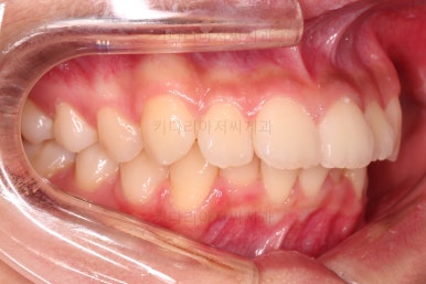 부산치아교정치과