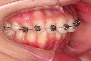 부산치아교정치과
