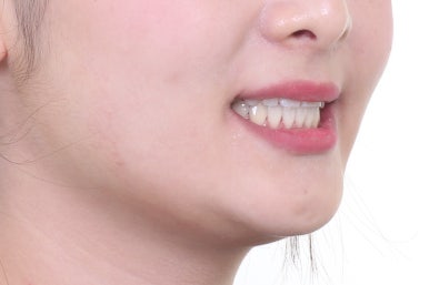 부산교정치과
