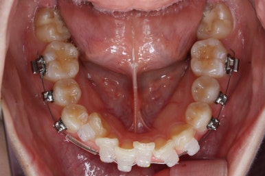 연산동교정치과