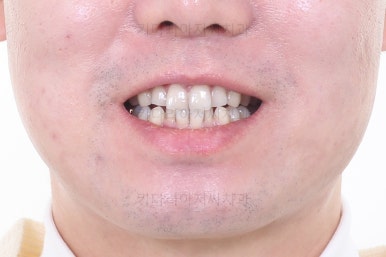 부산교정치과