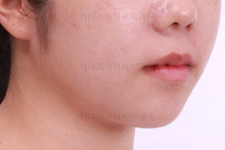 부산교정전문치과