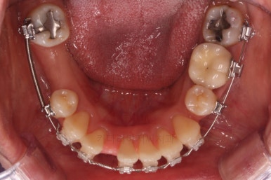 부산재교정치과