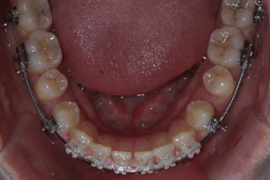 부산치아교정치과