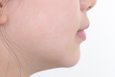 부산치아교정잘하는곳