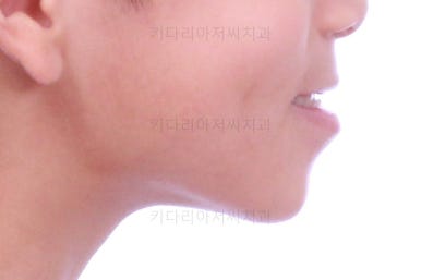 부산어린이교정