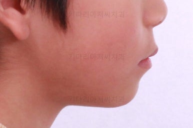 부산어린이교정