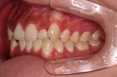 부산치아교정치과