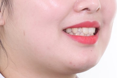 부산치아교정치과