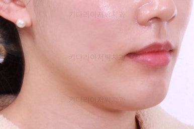 부산교정