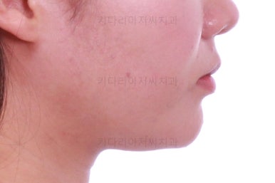 부산치아교정치과