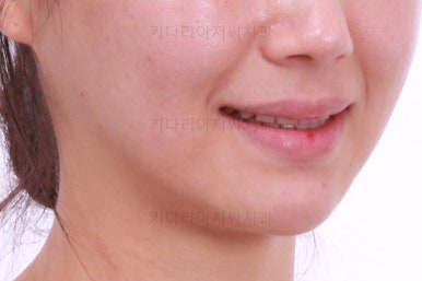 연산동교정치과